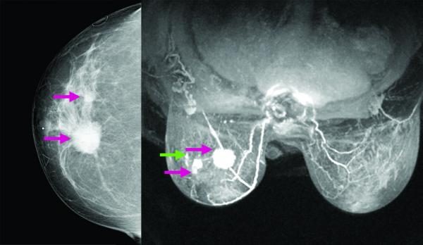 04-09-12 Chou composite