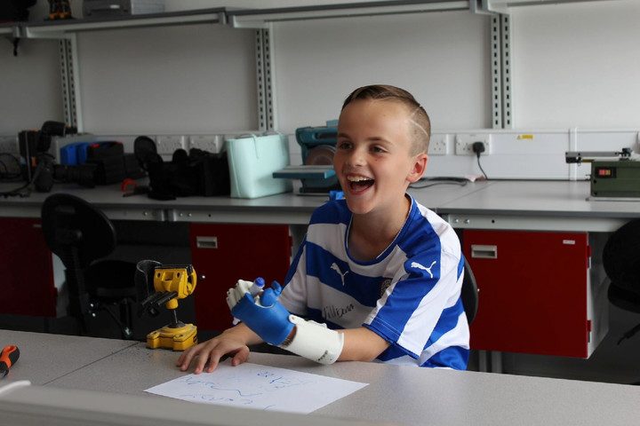 crean una protesis para un nino con impresora 3d 3dprint5 2 720x480 c