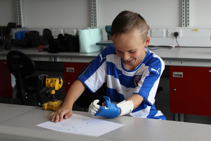 crean una protesis para un nino con impresora 3d 3dprinthand3 720x480 c