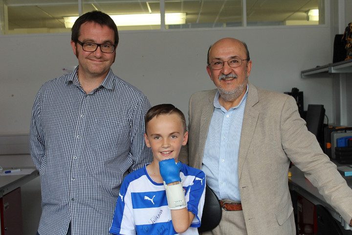 crean una protesis para un nino con impresora 3d 3dprinthand4 720x480 c