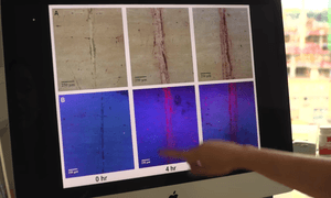 revolucionaria tecnica para escanear huesos en 3d captura de pantalla 2016 09 12 a las 20 43 45