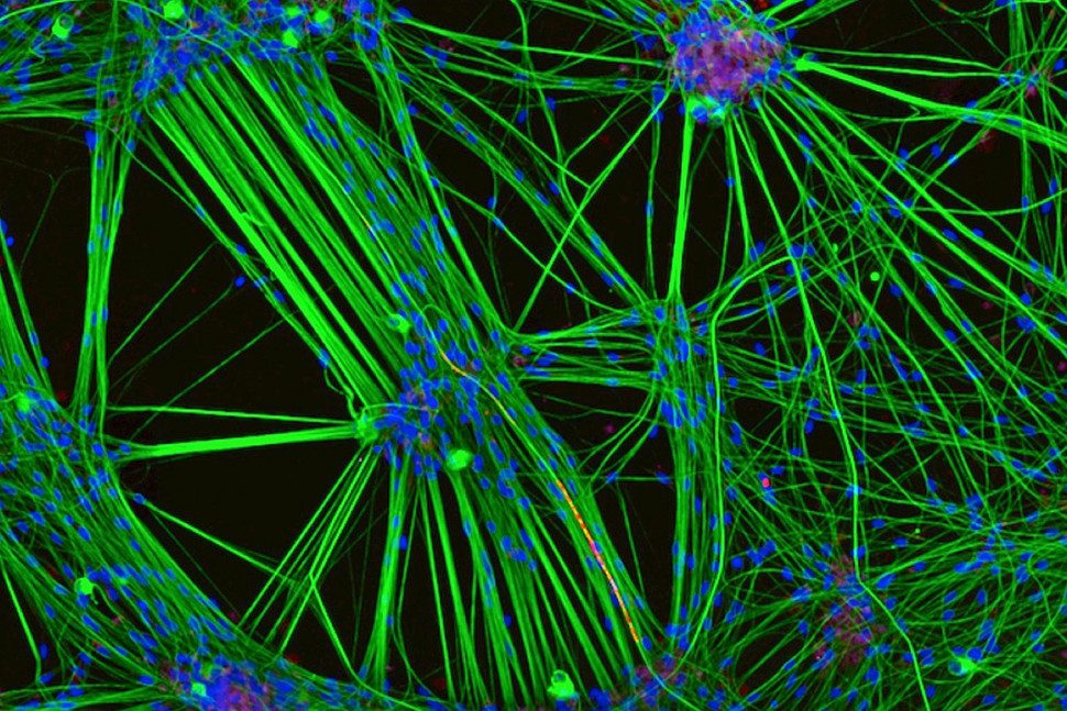 microfotografias macro concurso imrs php 3 970x647 c