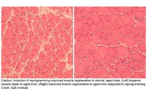 figure-muscle-720x720