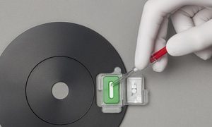 prueba de alergia AbioScope