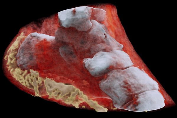 radiografias a colores ankle left view 600x400 c