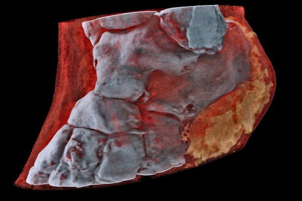 radiografias a colores ankle right view 600x400 c