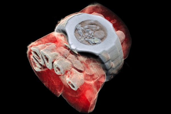 radiografias a colores image001 5 2 600x400 c