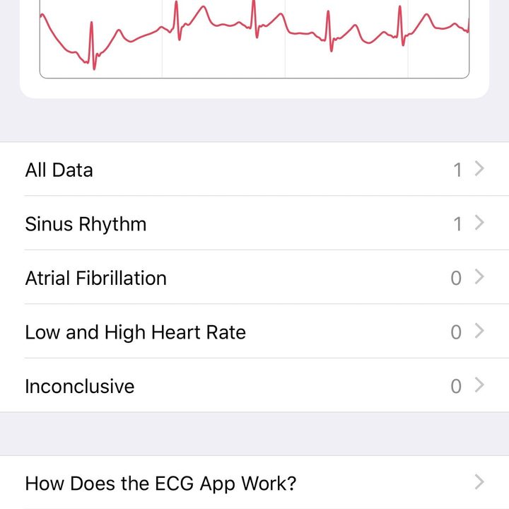 cmo usar la app ecg del apple watch health data 1242x2688