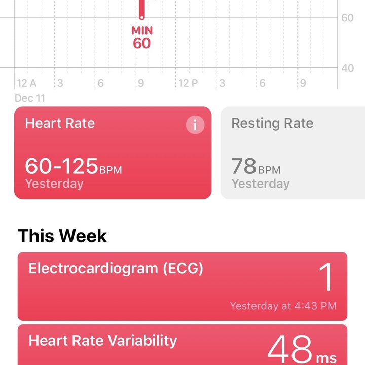 cmo usar la app ecg del apple watch health 1242x2688