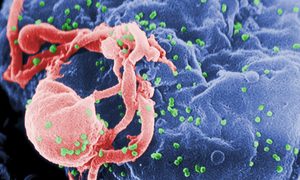 cura vih segundo caso hiv