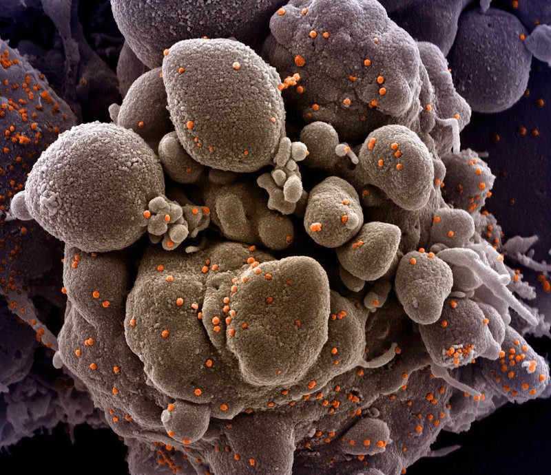 coronavirus imagen real microscopio 49679608176 7ce7639138 c