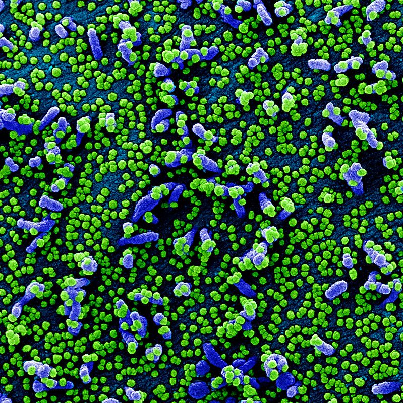 coronavirus imagen real microscopio 49680676102 a0ca68cf56 c