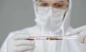 coronavirus examen sangre+