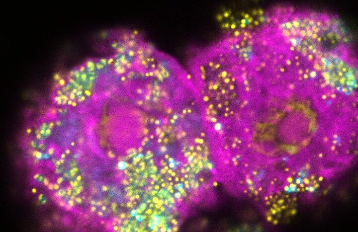 Dos células de ameba (rosa) infectadas con la bacteria parachlamydia