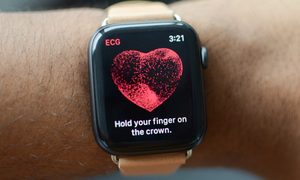 Apple patenta tecnología para controlar el reloj con gestos