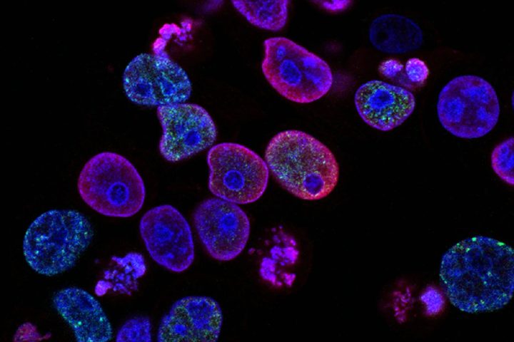 Células cangerígenas