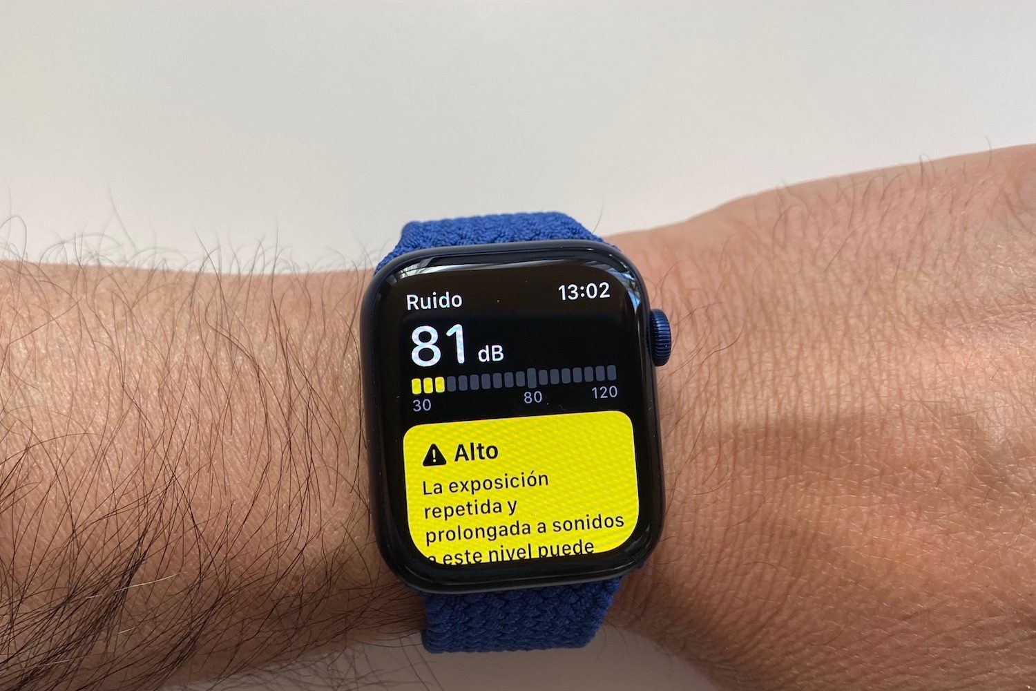 revision apple watch series 6 3