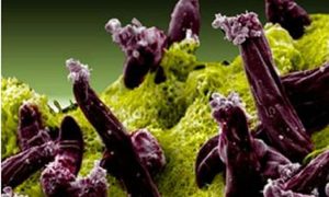 Una imagen del parásito que causa la malaria