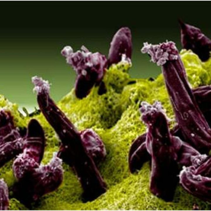 Una imagen del parásito que causa la malaria