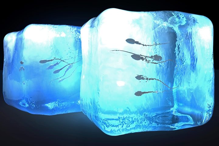 Espermatozoides congelados