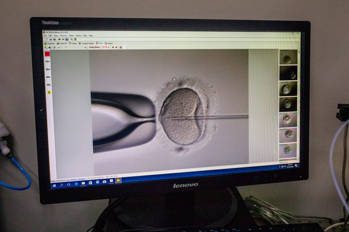 La especialista en salud pública Shanna Swan advierte que el mundo podría ser completamente infértil en 2045