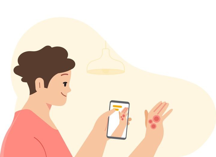 Google detección piel