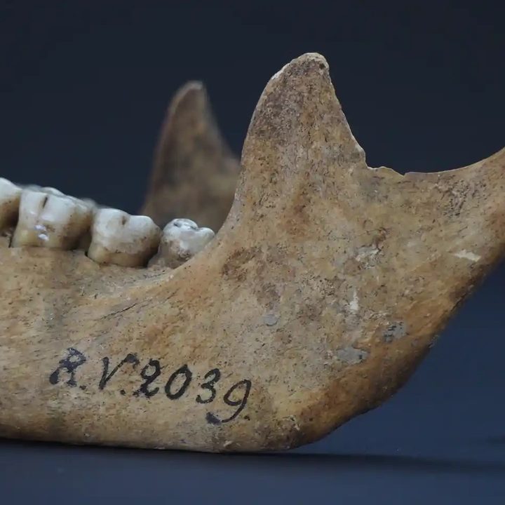 Cráneo de la primera víctima de peste de la historia