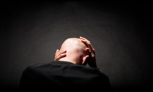 Chinos desarrollan un parche para combatir la calvicie