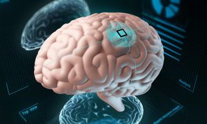 implante corporal para alzheimer te mata si olvidas desactivarlo sarco human brain with an implanted chip