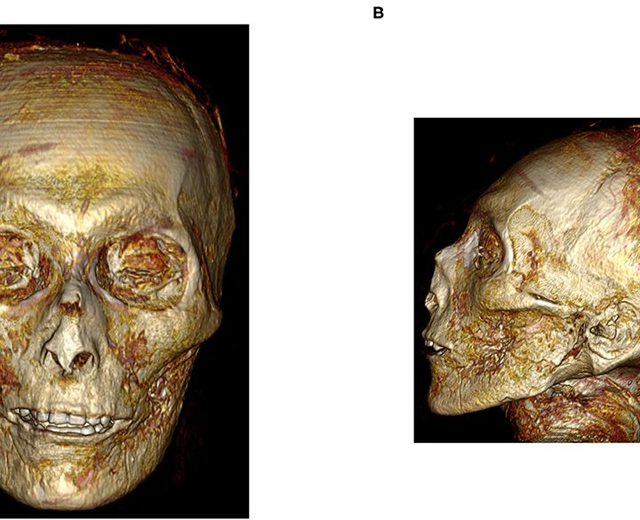 Científicos de Egipto realizan una tomografía 3D a la momia del faraón Amenhotep I