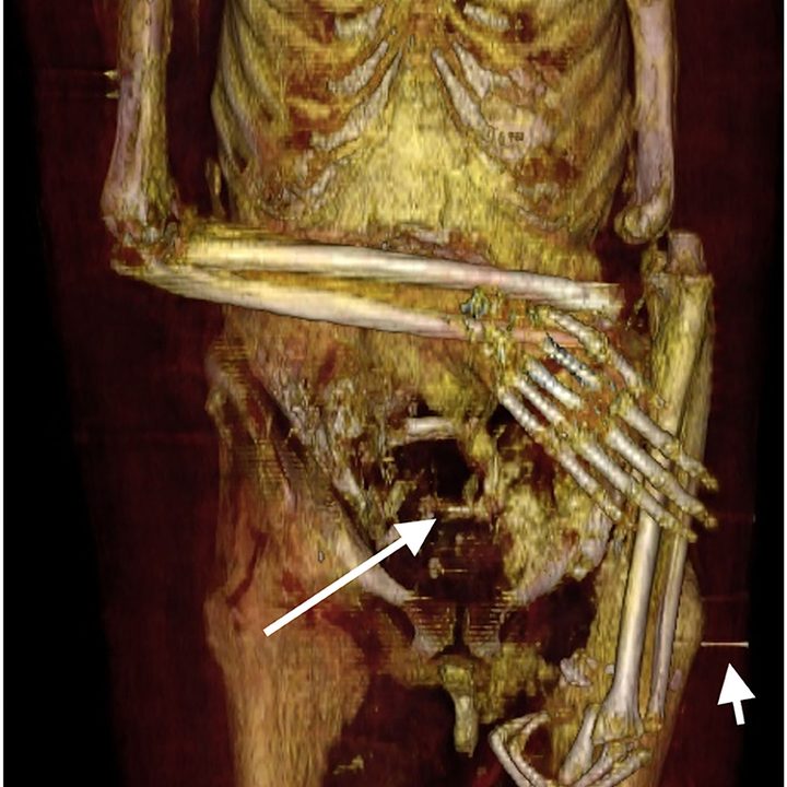 Científicos de Egipto realizan una tomografía 3D a la momia del faraón Amenhotep I