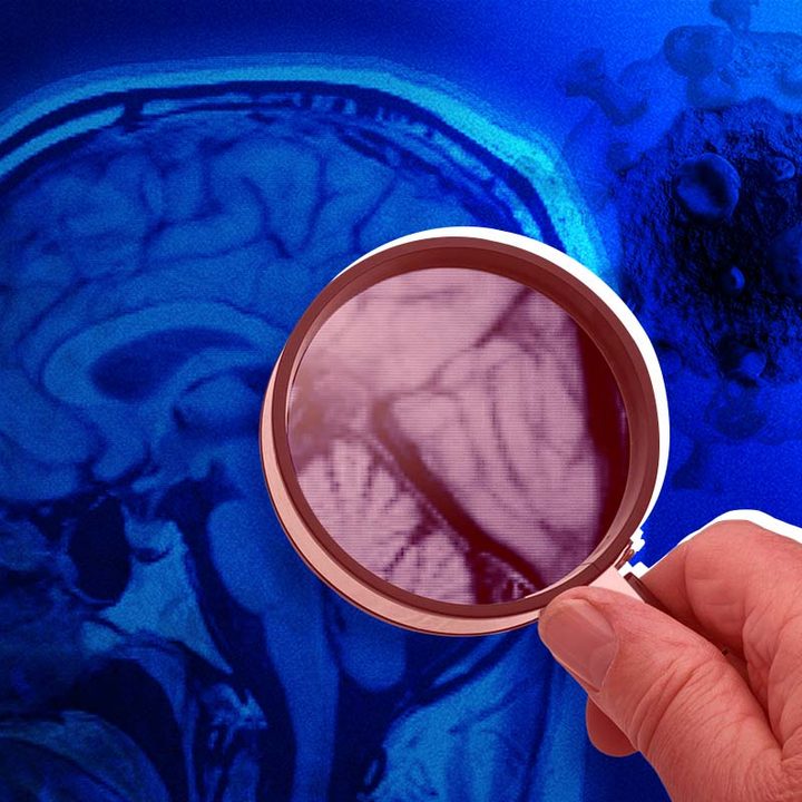 Una mano sosteniendo una lupa sobre la imagen de un cerebro, junto con una imagen del coronavirus.