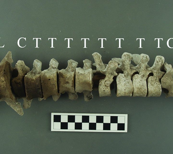 La imagen muestra las vértebras humanas halladas en Perú.