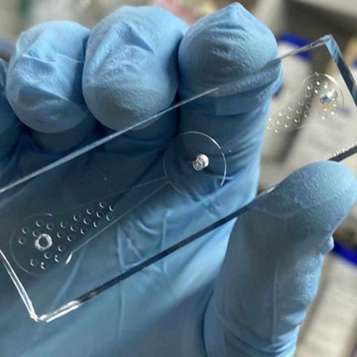 Cómo un simple gusano puede diagnosticar el cáncer de pulmón