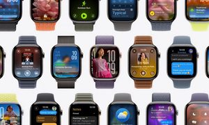 Apple Watch series 11
