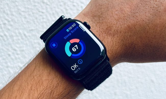 Wristwatch, Arm, Body Part