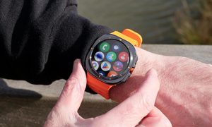 Wristwatch, Arm, Body Part