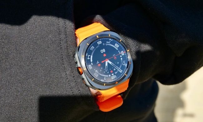 Wristwatch, Arm, Body Part