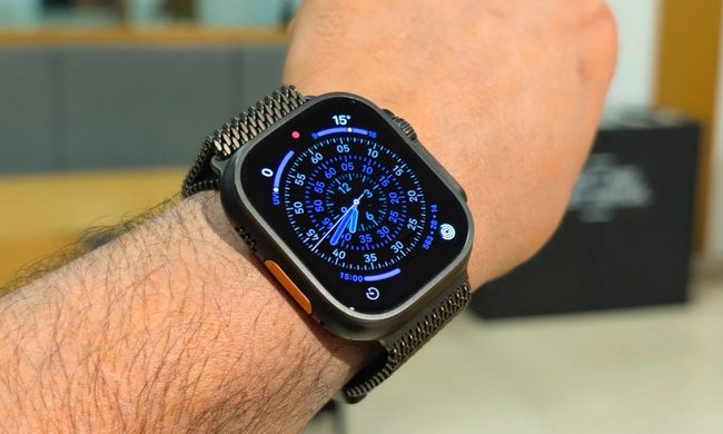 Wristwatch, Arm, Body Part