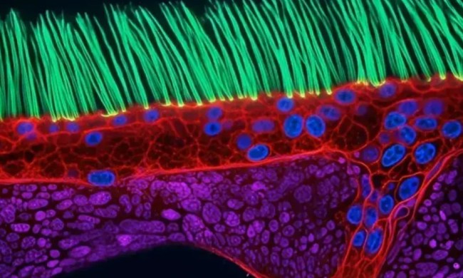 Foto microscópica