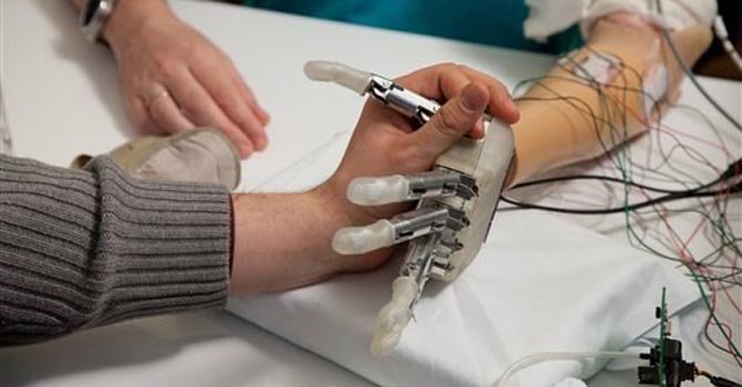 presentan primera protesis que permite al usuario recuperar el sentido del tacto mano artificial t670x470