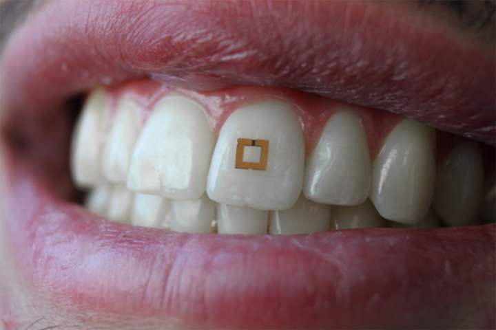 sensor dental inteligente