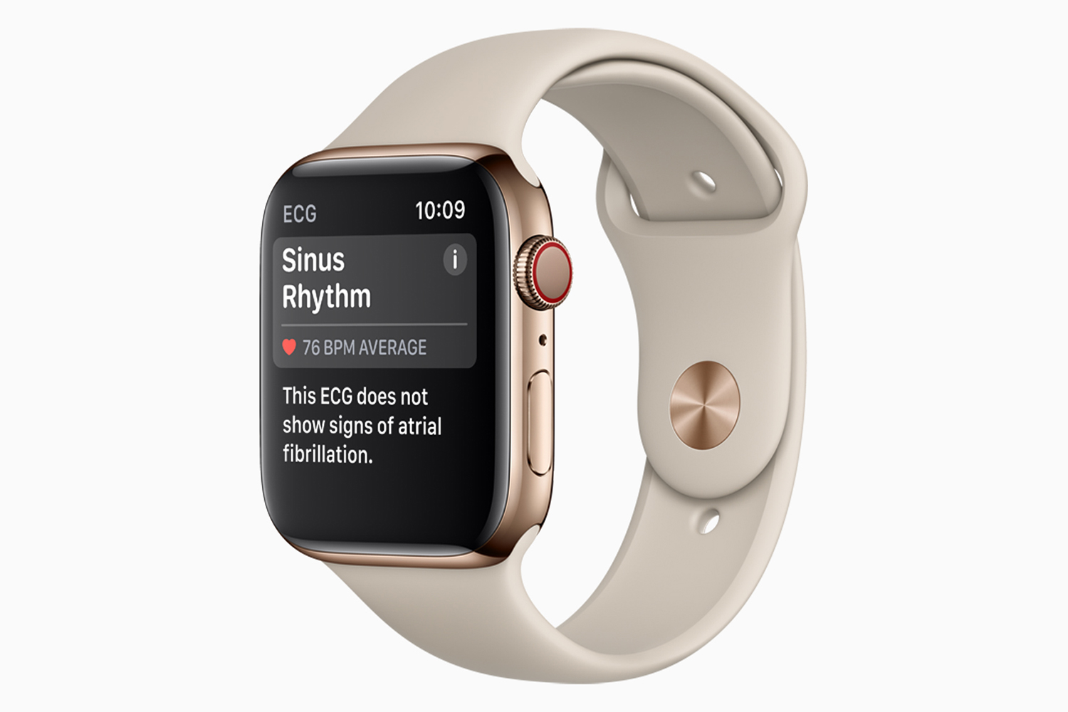 Todo sobre la función de electrocardiograma del Apple Watch | Digital  Trends Español
