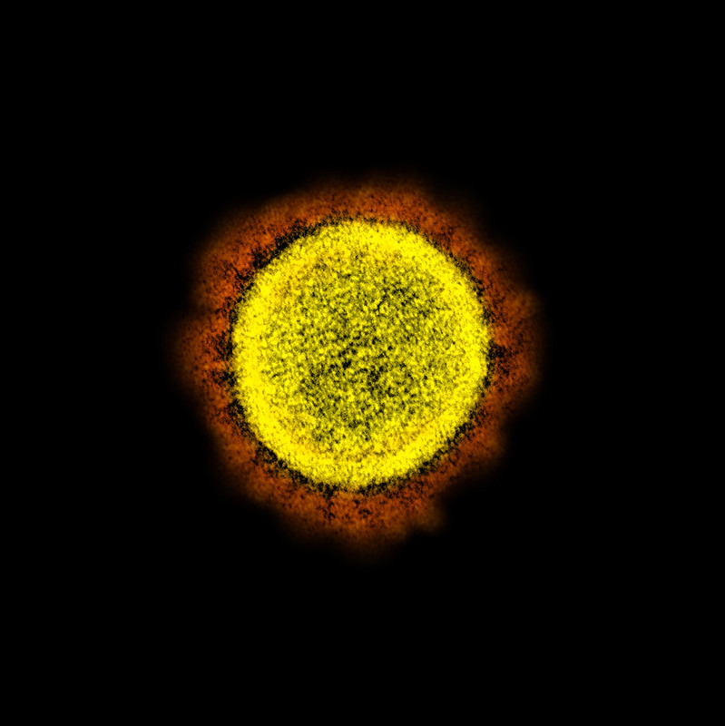 coronavirus imagen real microscopio 49651434338 0725a7cc03 c