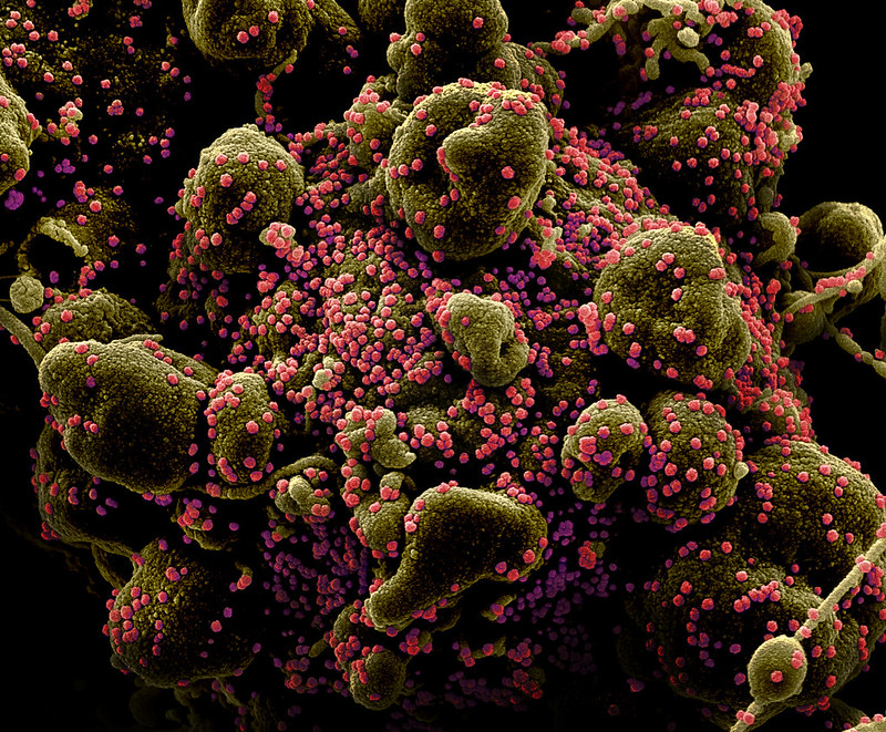 coronavirus imagen real microscopio 49680675977 8a90d9e21a c