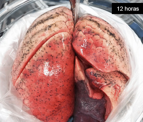 Imagen de un pulmón en estudio de la Columbia University