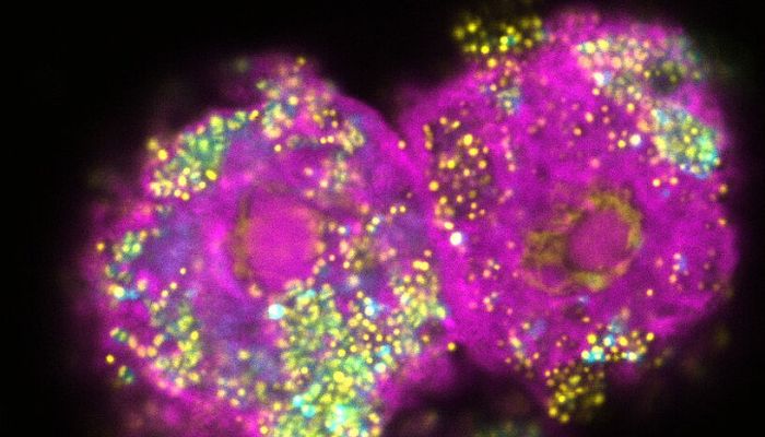 Dos células de ameba (rosa) infectadas con la bacteria parachlamydia
