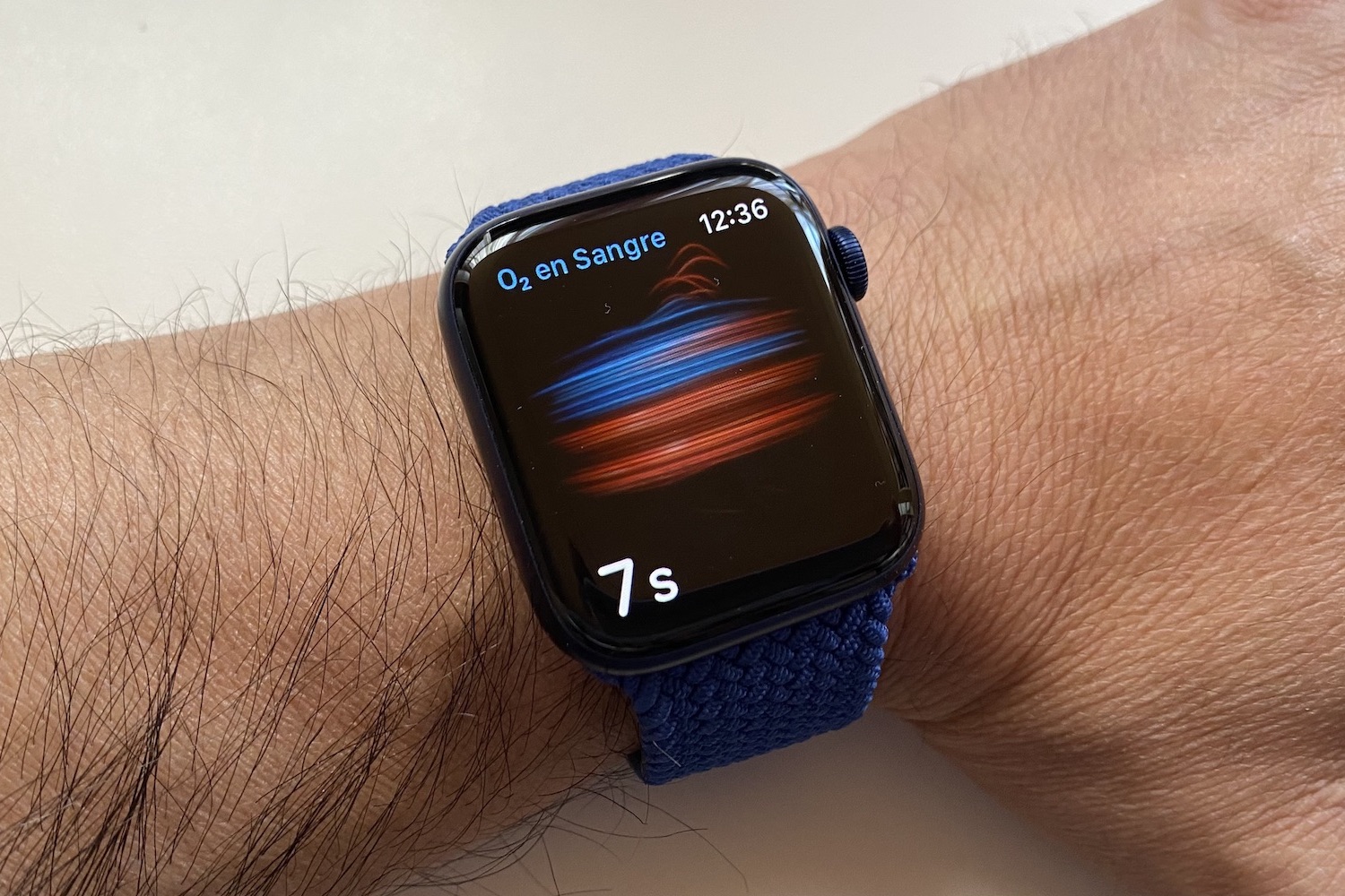 revision apple watch series 6 1