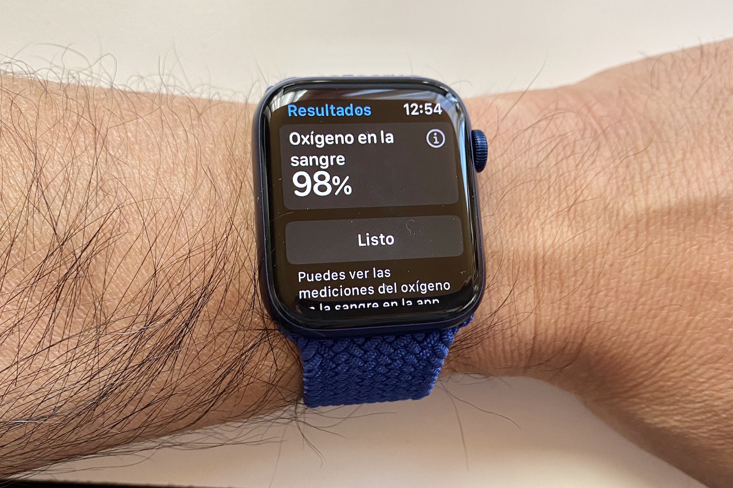 revision apple watch series 6 10
