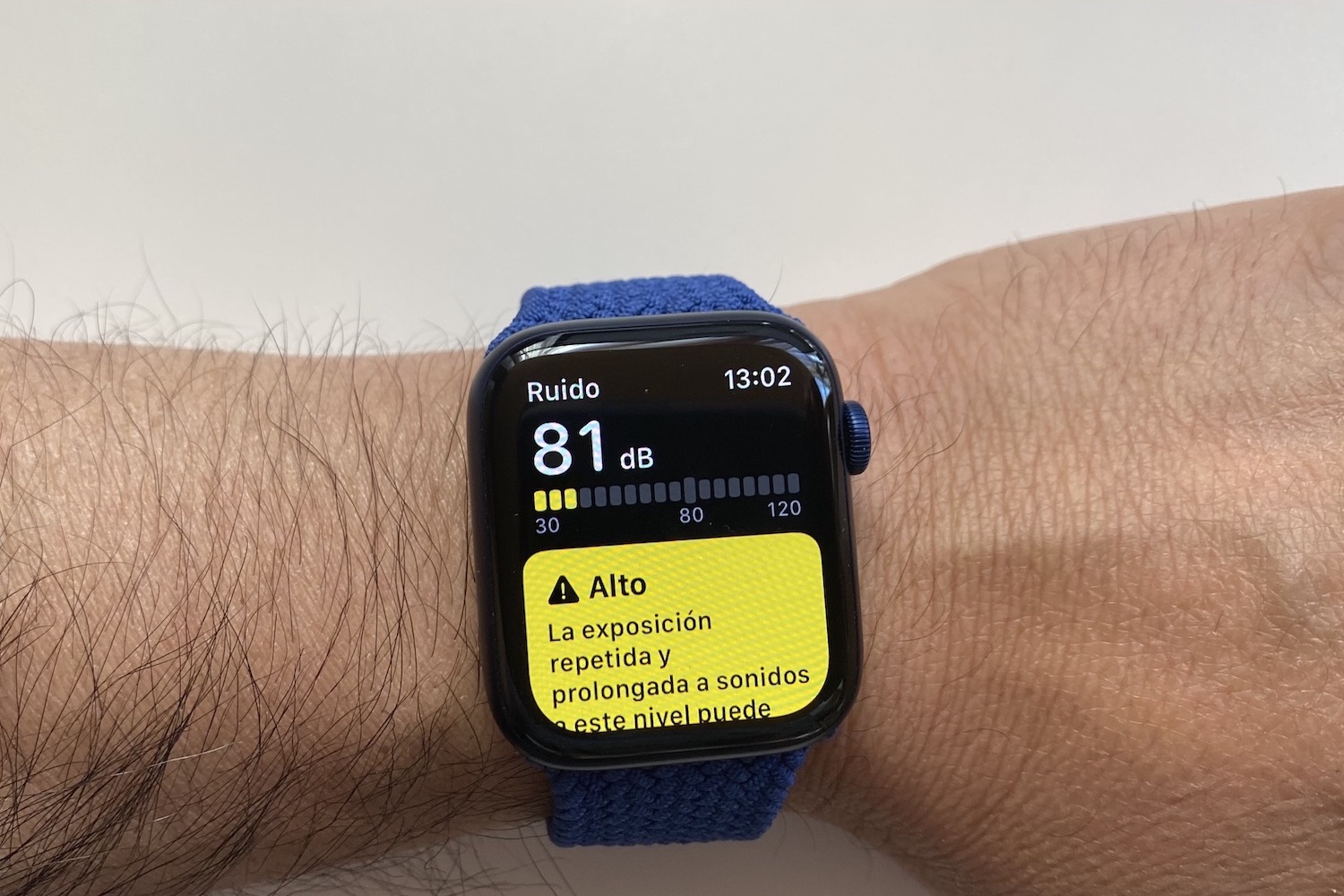 revision apple watch series 6 3